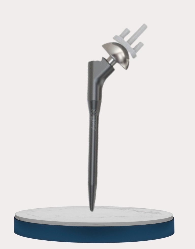 Anatomic Shoulder Replacement